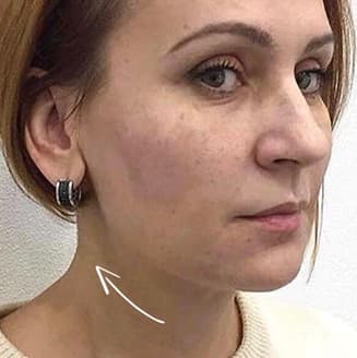 Після